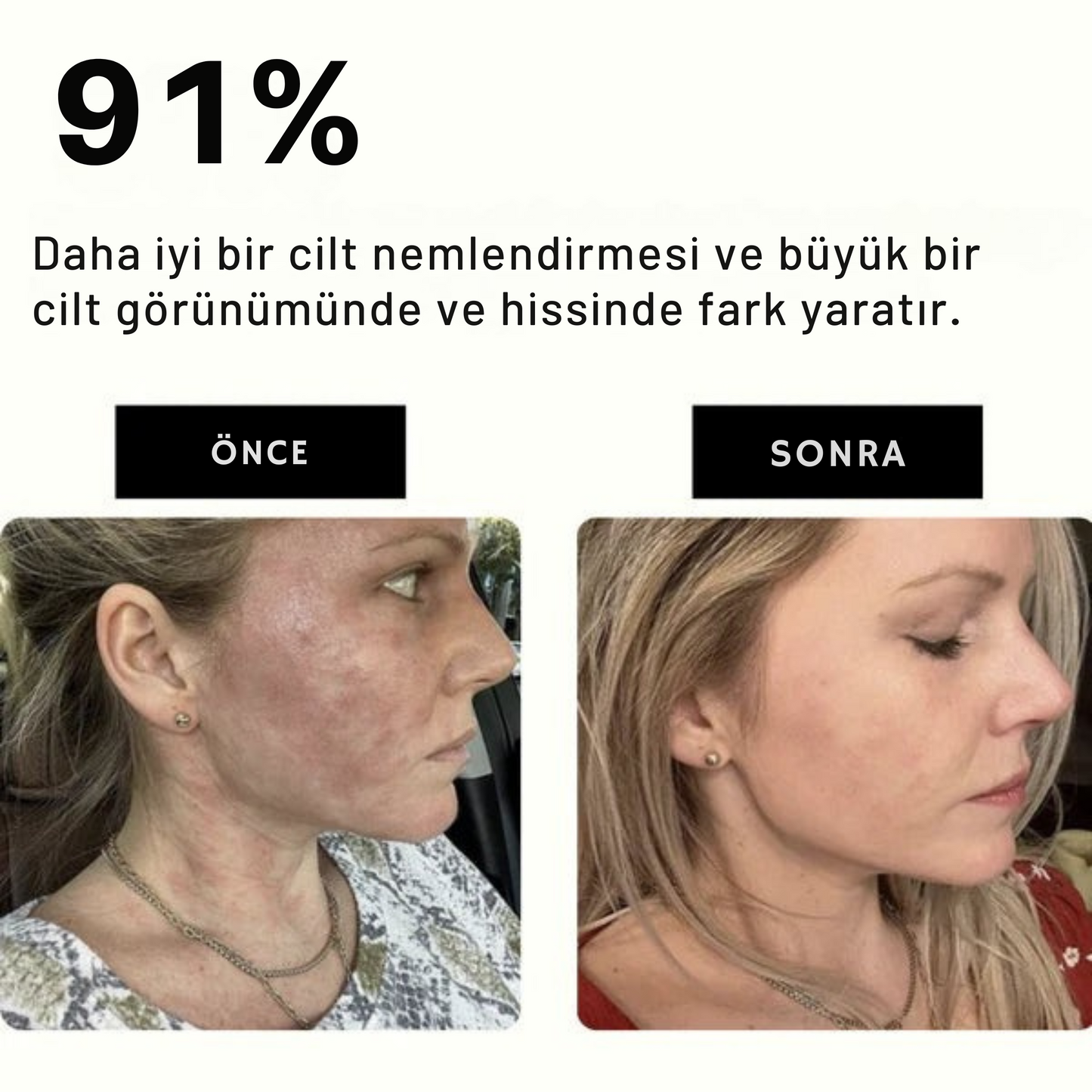 Filtreli Nemlendirici Duş Başlığı